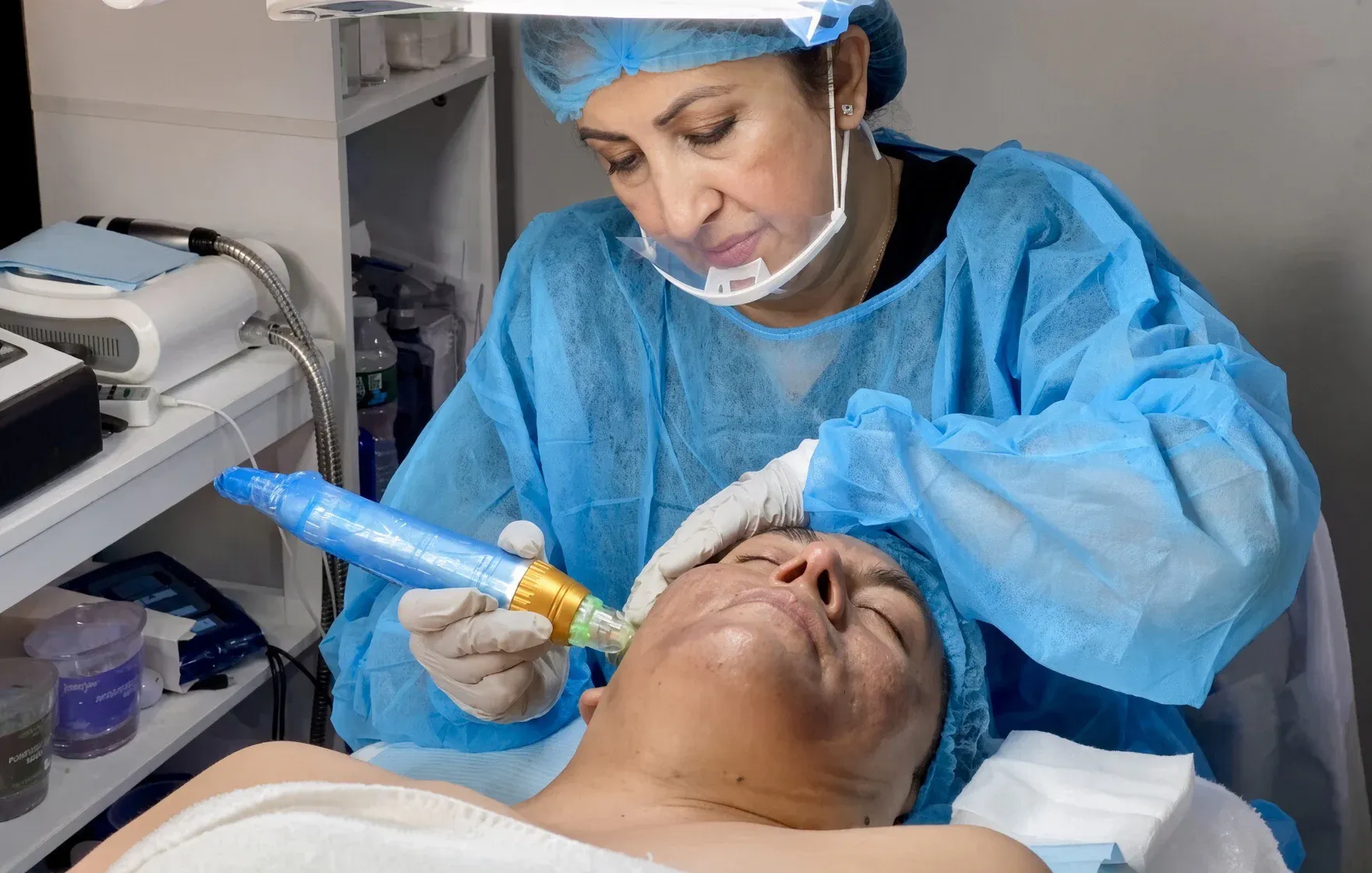 Una especialista de Studio B, con bata, gorro y careta, hace microneedling en el rostro de un cliente